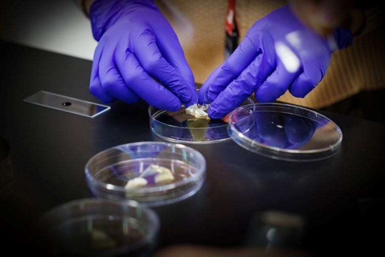 Student uses a piece of tape to take a sample of moldy cheese and transfer it to a slide.