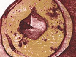 Allie Wheeler, &ldquo;Records,&rdquo; 2026. 10&rdquo; x 12&rdquo;. Intaglio Collagraph. 