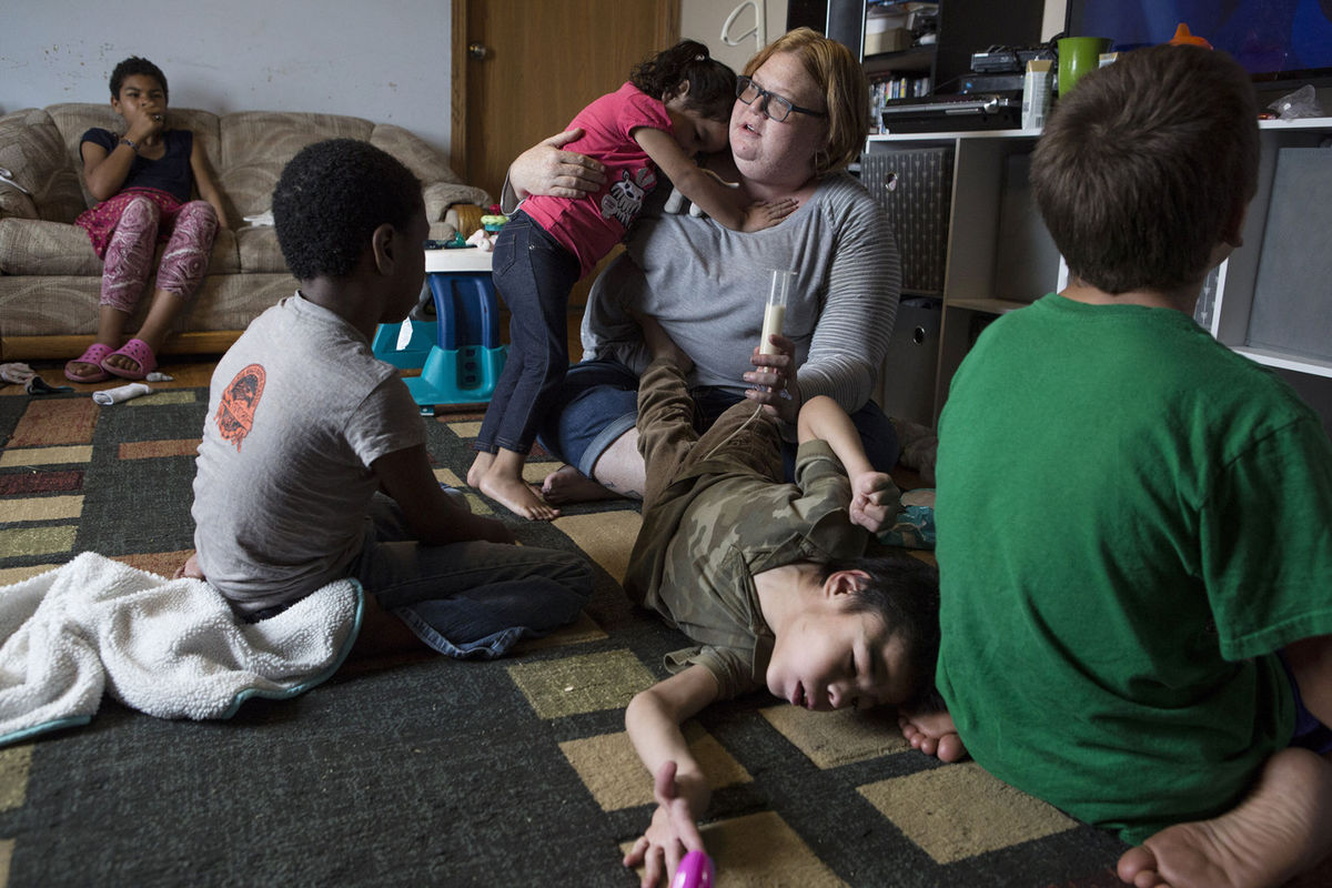 Nora Boesem feeds her son A.J. through a feeding tube at their house in Newell, South Dakota.