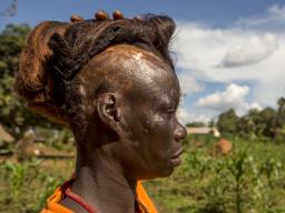 Polline Angeyo lifts her wig to reveal scars from the 1995 LRA attack on her home village of Awach in northern Uganda. Polline's story is one of many which will be told at the Global Eyewitness showcase Nov. 16.